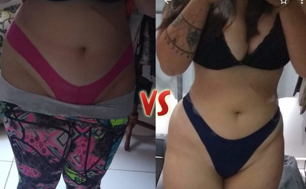 Antes e Depois Lateral